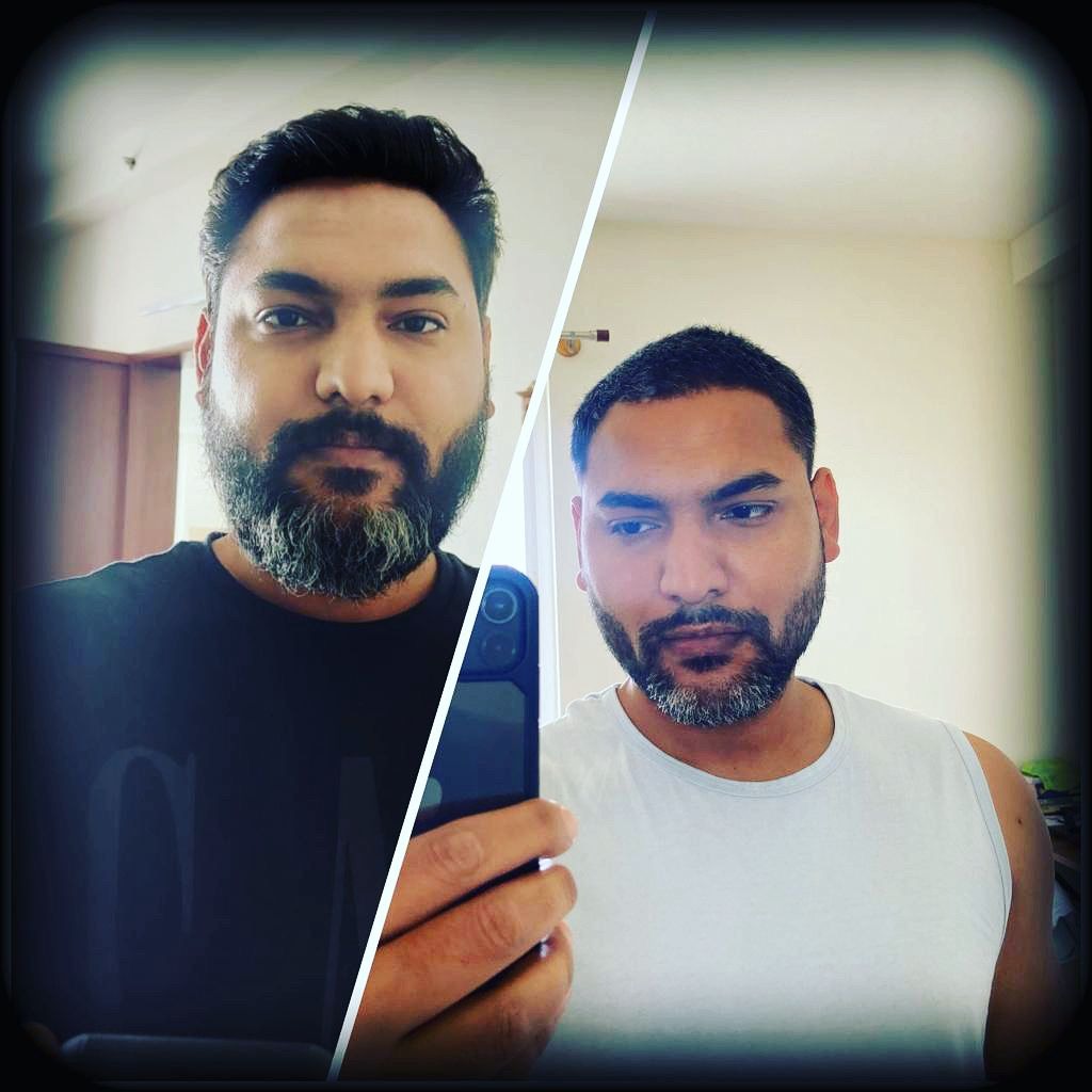 Anuj 16 Week Transformation